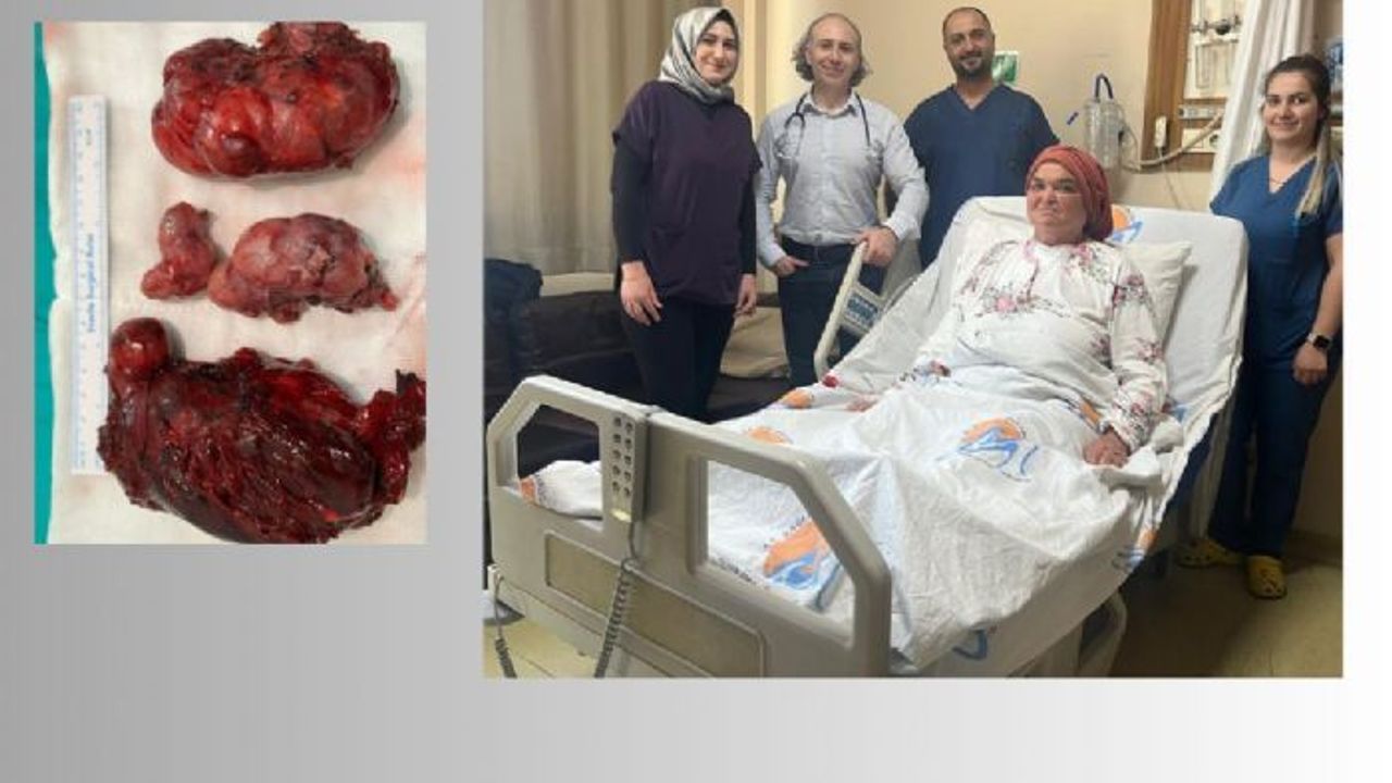 Dev Guatr Ameliyatı: 1 Kilo 560 Gramlık Kitle Çıkarıldı