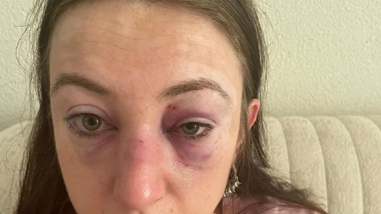 Bursa'da kadına şiddet