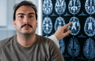Toplum epilepsiyi görmezden geliyor