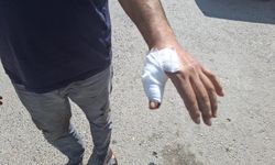 Kurbanlıklardan çok kasaplar yaralandı