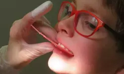 Yaz Aylarında Çocuklarda Diş Sağlığına Dikkat!