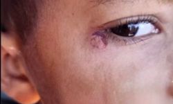 Öğrencinin Yüzünde Sigara Söndürdü: Temizlikçi Tutuklandı