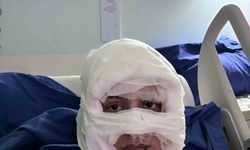 Genç kadın başka bir kadın tarafından ateşe verildi