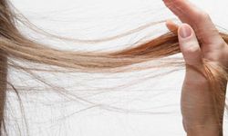 Saçlarınız Neden Zayıflıyor? Uzmanların Uyardığı 6 Alışkanlık