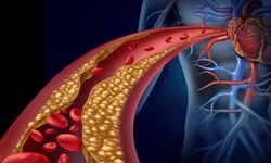 Yüksek Kolesterolünüz Varsa Bu Peynirden Uzak Durun