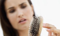 Kışın Sıcak Kalırken Saçlarınızı Kaybetmeyin: Uzmanlar Uyarıyor