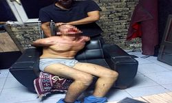 Genç İşçiye Böcek Yedirerek İşkence Yaptılar: Sanıklara 7’şer Yıl Hapis Cezası