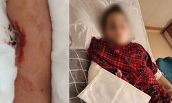 Okulda Akran Zorbalığı: 9 Yaşındaki Öğrenci 8 Yaşındaki Arkadaşının Kolunu Kırdı