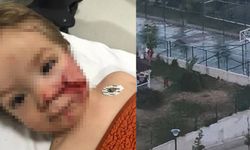 Ankara’da Pitbull Dehşeti: Sahibi Tasmasız ve Ağızlıksız Gezdirmiş