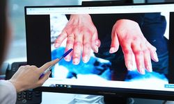 Soğuk Hava Cildi Sessizce Tehdit Ediyor