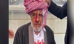 Şanlıurfa'da Sopayla Darba 4 Tutuklama