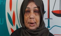 Polis Memuru Eşi Tarafından Darbedildiği İddiası