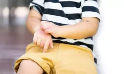 Uzmanından Uyarı: Egzama Çocuk ve Erişkinlerde Yaşam Kalitesini Düşürüyor