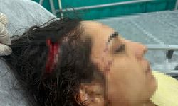 Adana'da Sokak Köpeklerinin Saldırısında Yaralandı