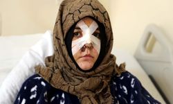 Kaldırım Taşıyla Darbedilen Nazlı: "Hapisten çıkarsa yarım bıraktığı işi tamamlar"