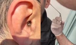 Kulağına gizlediği uyuşturucuyla yakalandı