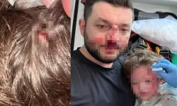 Sopalı saldırının ardından yeni olay: Küçük çocuğa taşlı saldırı