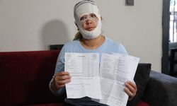 Güzelleşmek isterken yüzü yandı