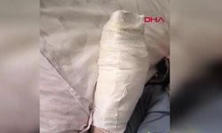 Yürüyen merdivene eli sıkıştı: Parmağı koptu