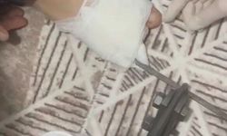 Mangal şişi ayağına saplandı