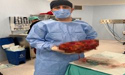 Karın ağrısı şikayetiyle doktora gitti, 8 kiloyu aşan böbreği alındı