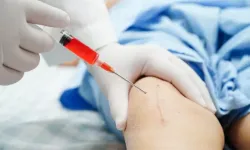 Türkiye’yi kök hücre naklinde yabancılar da tercih diyor