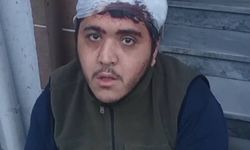 Sultangazi'de zihinsel engelli ve annesine sopalı saldırı