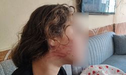Adana’da sokak ortasında şiddet: 11 yaşındaki kız çocuğu darp edildi