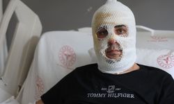 Ekmek teknesi küle dönmesin diye çabalarken yüzü yandı