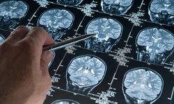Derin uyku Alzheimer’ın ilerlemesini yavaşlatabilir