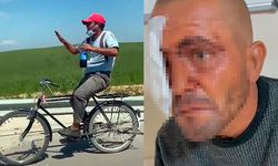 Zihinsel engelli Selçuk Demir'i darbeden şüpheliler aranıyor