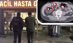 Mide ve bağırsaklarında 101 parça uyuşturucu çıktı