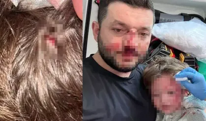 Sopalı saldırının ardından yeni olay: Küçük çocuğa taşlı saldırı