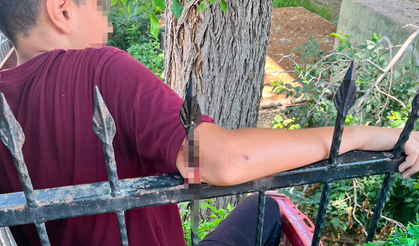 Demir korkuluk öğrencinin koluna saplandı, itfaiye kurtardı