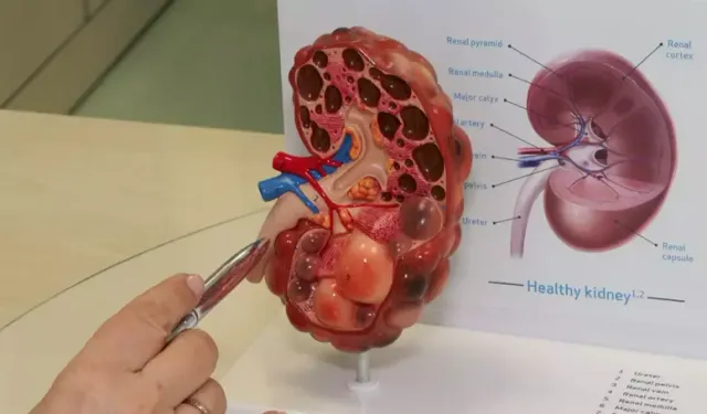 Yazın Böbrekleri Korumak İçin Su Tüketimine Dikkat!