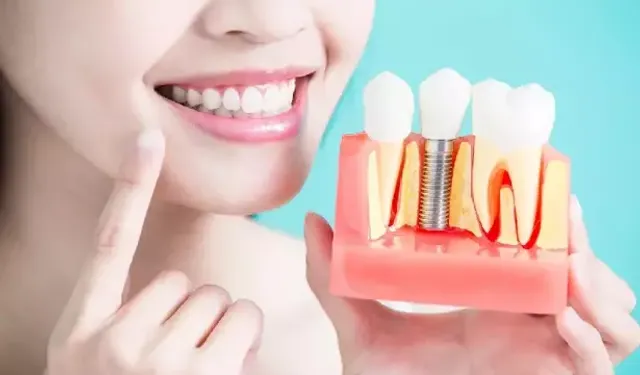 Gülüş Tasarımı Sadece Estetik Değil: Fonksiyonel ve Kişiye Özel
