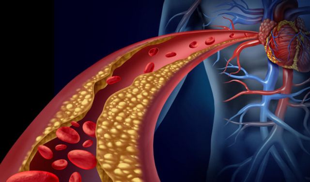 Yüksek Kolesterolünüz Varsa Bu Peynirden Uzak Durun
