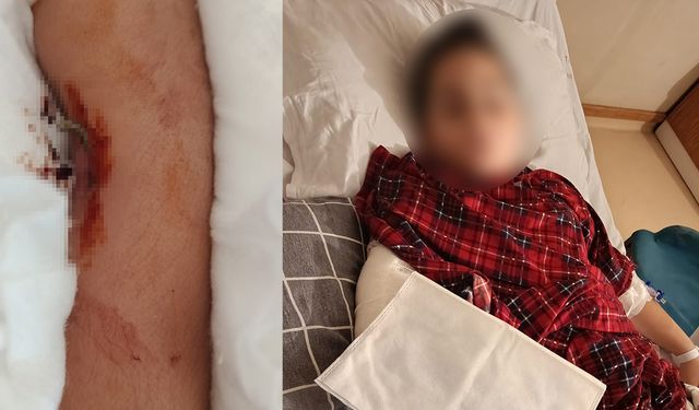 Okulda Akran Zorbalığı: 9 Yaşındaki Öğrenci 8 Yaşındaki Arkadaşının Kolunu Kırdı