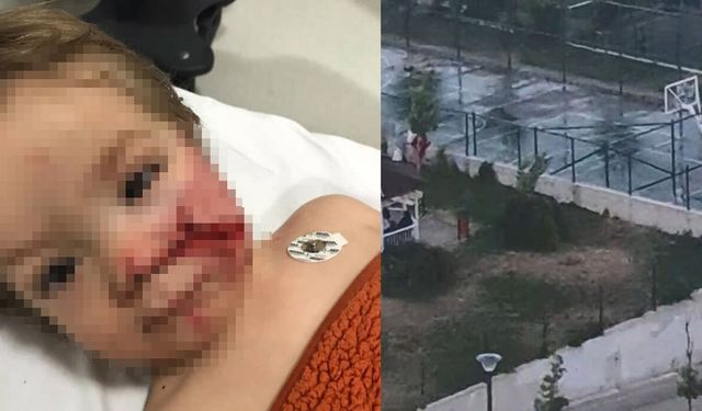 Ankara’da Pitbull Dehşeti: Sahibi Tasmasız ve Ağızlıksız Gezdirmiş