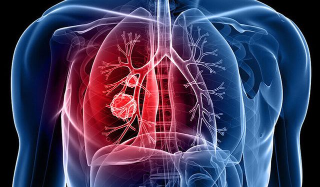 Verem Hala Ölümcül Bir Tehdit: “Erken Tanı Hayat Kurtarır, Toplumu Korur”