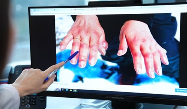 Soğuk Hava Cildi Sessizce Tehdit Ediyor