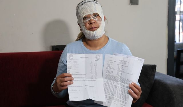 Güzelleşmek isterken yüzü yandı