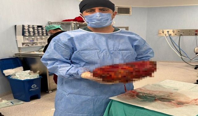 Karın ağrısı şikayetiyle doktora gitti, 8 kiloyu aşan böbreği alındı