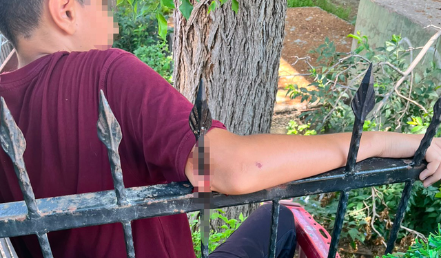 Demir korkuluk öğrencinin koluna saplandı, itfaiye kurtardı