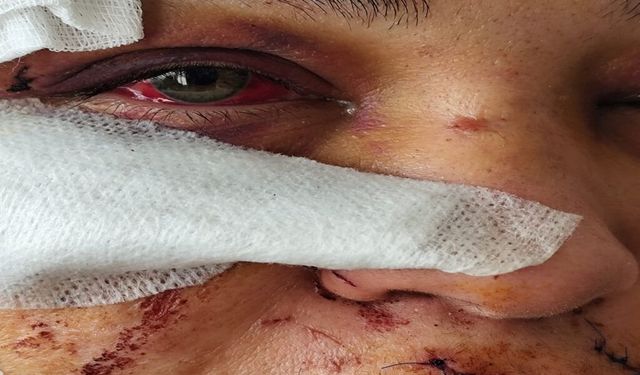 Boşanma aşamasındaki eşini darbeden polis memuruna hapis ve tahliye
