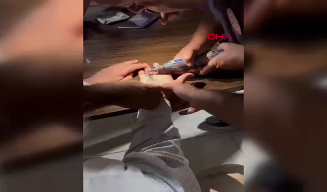 Parmağına sıkışan yüzüğü itfaiye çıkardı