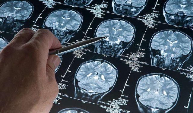 Derin uyku Alzheimer’ın ilerlemesini yavaşlatabilir