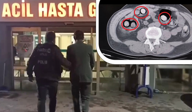 Mide ve bağırsaklarında 101 parça uyuşturucu çıktı