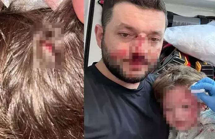 Sopalı saldırının ardından yeni olay: Küçük çocuğa taşlı saldırı