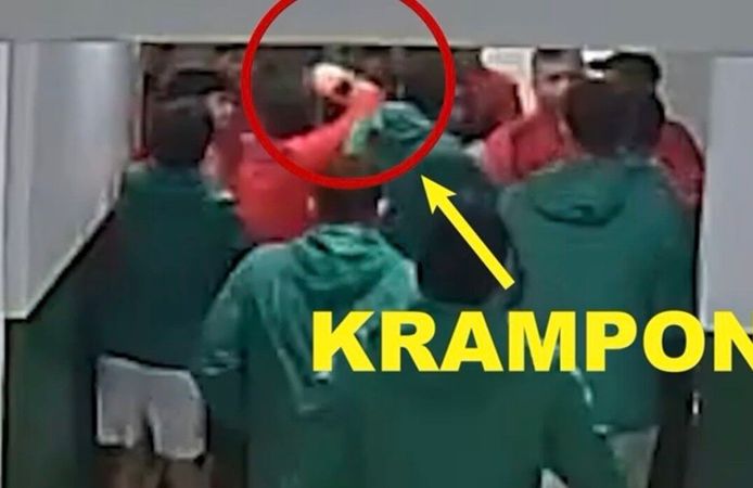 Maç öncesi ortalık karıştı: Futbolcular kramponlarla darbedildi